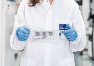 Al lavoro nell&rsquo;azienda dei test anti Covid 19: selezioni DiaSorin per i laboratori